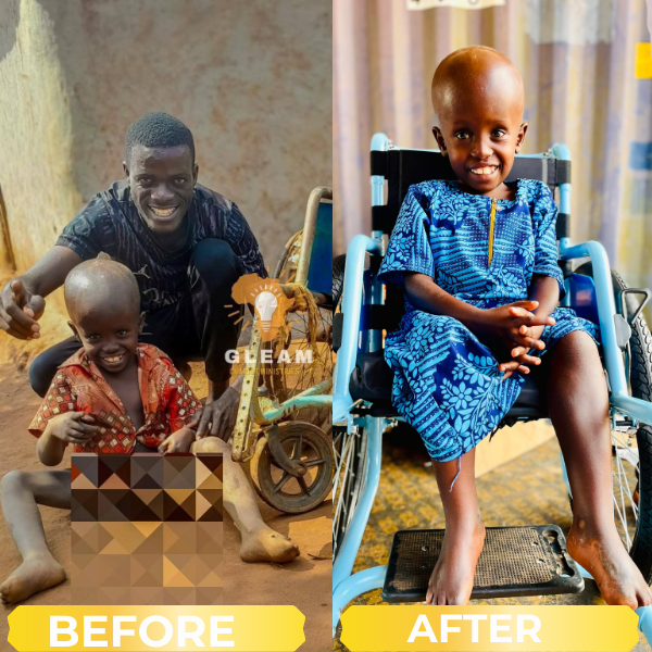 Before and after wheelchair support case 1